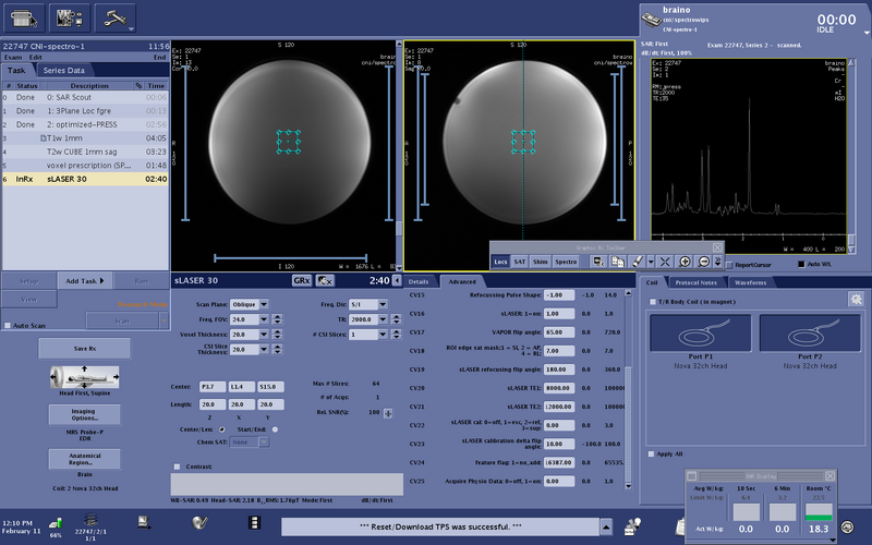 File:Slaser-3.png