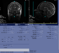 Thumbnail for version as of 17:24, 23 August 2023