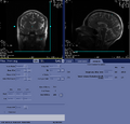 Thumbnail for version as of 17:24, 23 August 2023