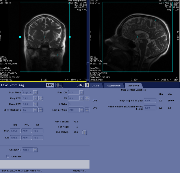 File:T1w 07mm sag adv.png