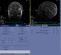 Thumbnail for version as of 17:08, 23 August 2023