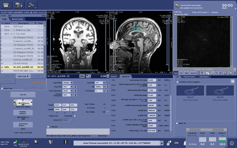 File:Testcsi52 ACC Advanced 2of2.png