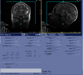 Thumbnail for version as of 17:09, 23 August 2023