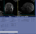 Thumbnail for version as of 17:09, 23 August 2023