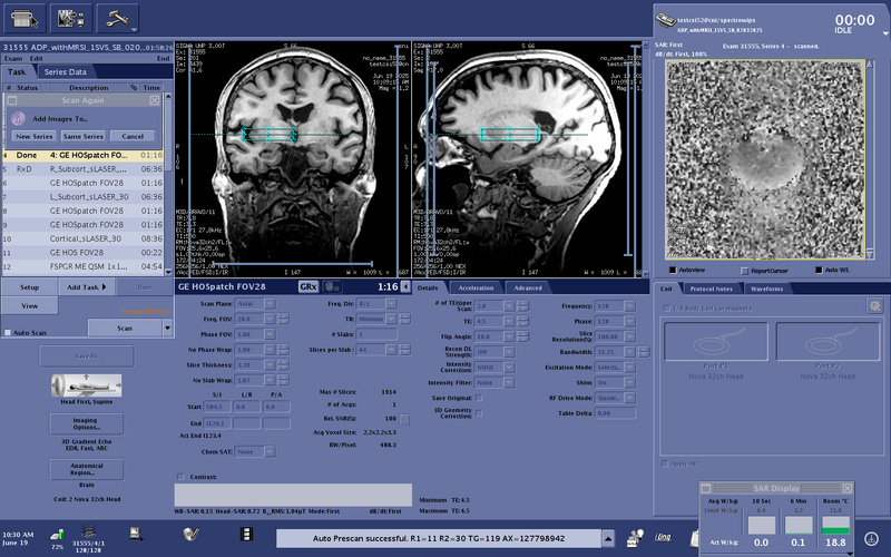 File:Testcsi52 HOSpatch sameSeries.png