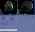 Thumbnail for version as of 17:24, 23 August 2023