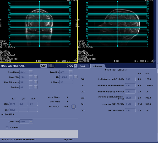 File:Hos wb hrbrain adv.png