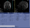 Thumbnail for version as of 17:24, 23 August 2023