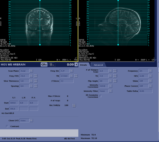 File:Hos wb hrbrain details.png