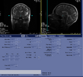Thumbnail for version as of 17:09, 23 August 2023