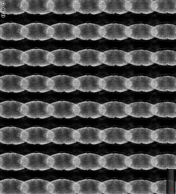 Using the wrong vrgf file (try to find the right one, or use one from a comparable scan).