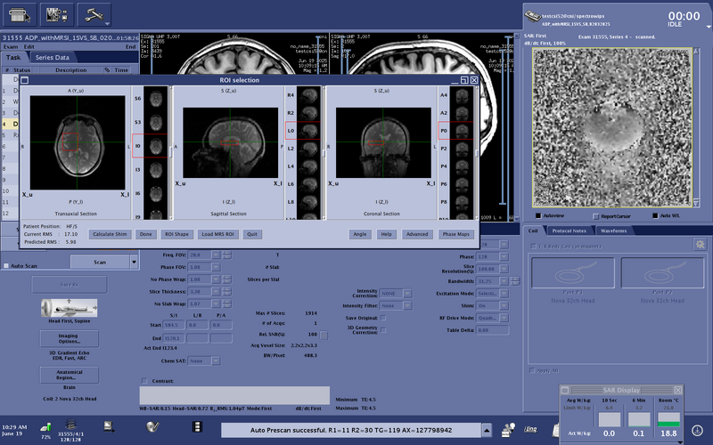 File:Testcsi52 HOSpatch ROIselection calcShim.png