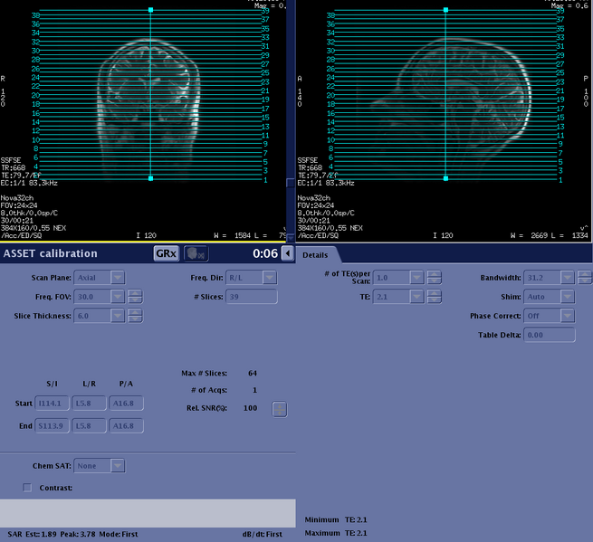File:Asset calibration details.png