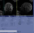 Thumbnail for version as of 17:24, 23 August 2023