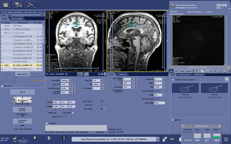 File:Testcsi52 ACC details useThisOne.png
