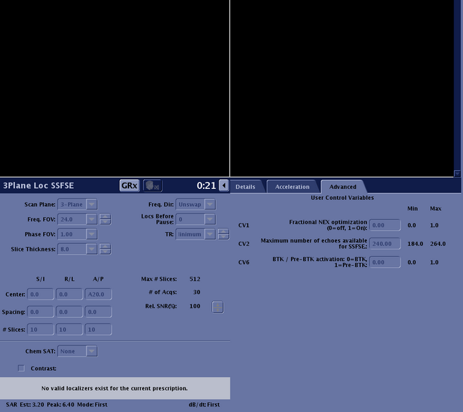 File:3planeloc adv.png