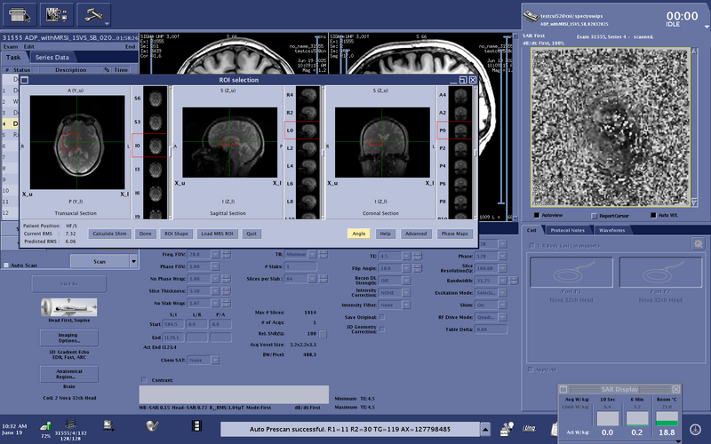 File:Testcsi52 HOSpatch calcShim 2.png
