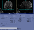 Thumbnail for version as of 17:09, 23 August 2023