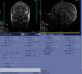 Thumbnail for version as of 17:09, 23 August 2023
