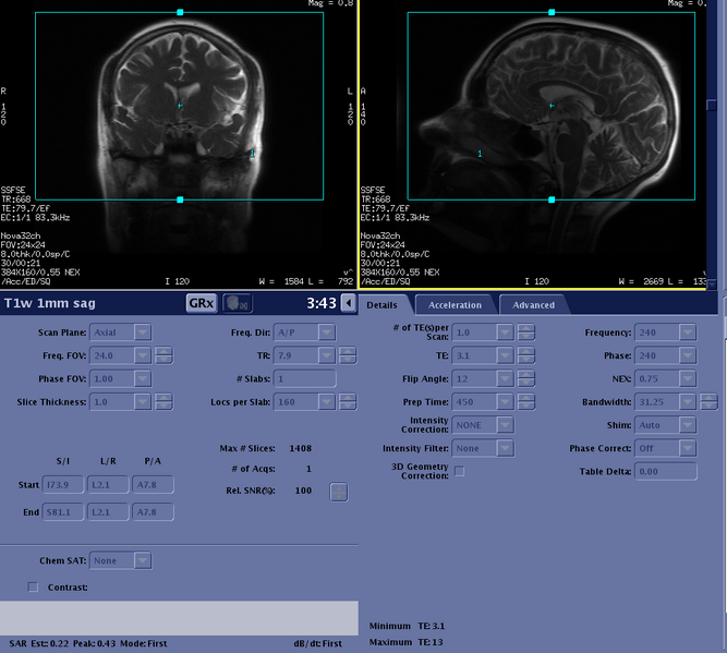 File:T1w 1mm sag details.png