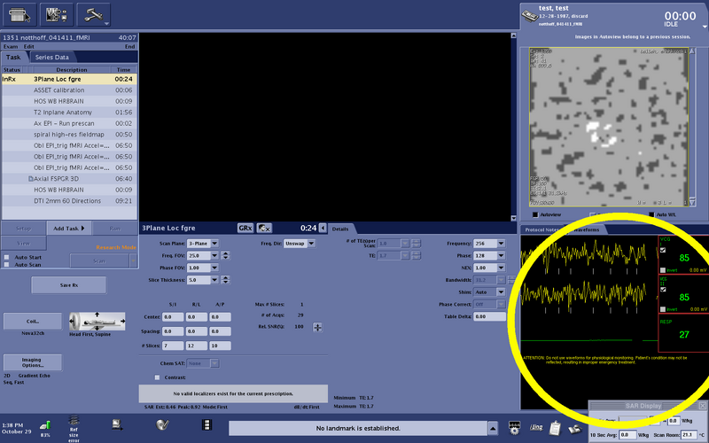 File:Physio waveforms.png