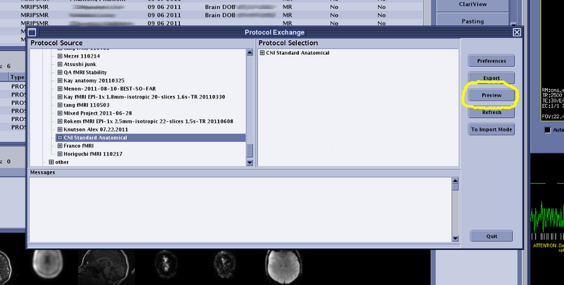 File:ProtocolSelection.png
