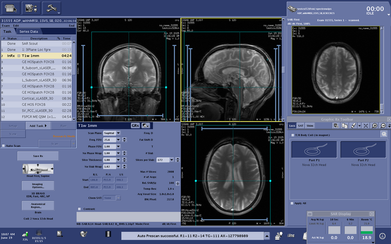 File:Testcsi52 T1 rx.png