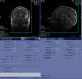 Thumbnail for version as of 17:10, 23 August 2023