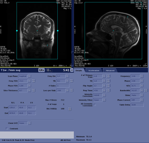 File:T1w 07mm sag details.png