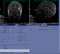 Thumbnail for version as of 17:10, 23 August 2023